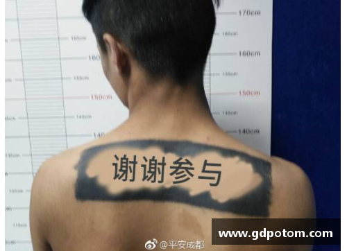 星光彩票身上的纹身该如何去掉？洗纹身两大方法让你轻松战胜纹身